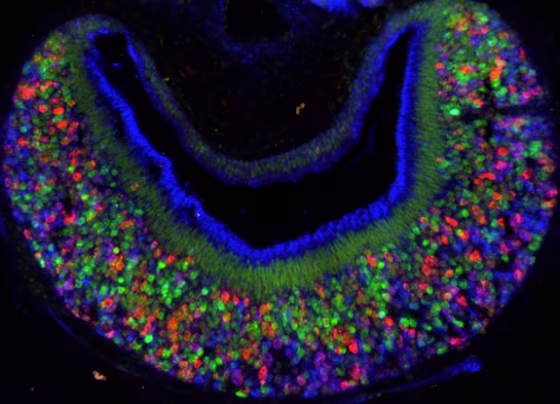 Image: Mouse vomeronasal organ in nose